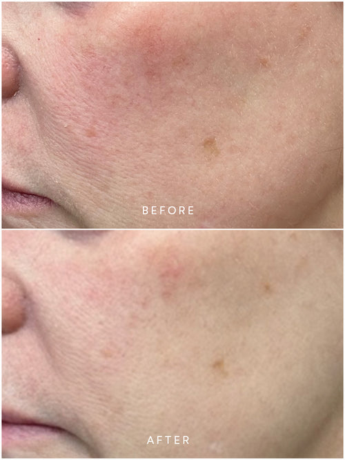 Renew Microbiome Enzyme Essence