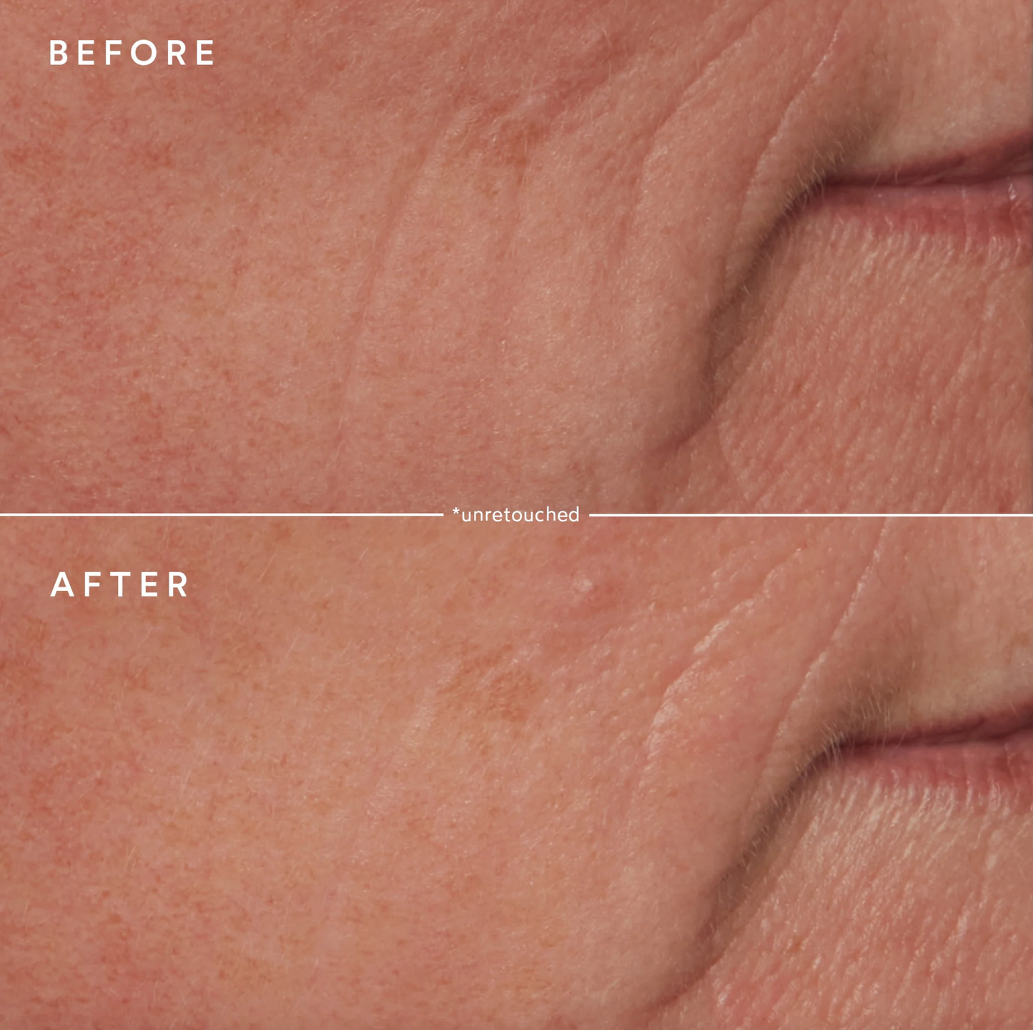 Moisture Lock Barrier Cream