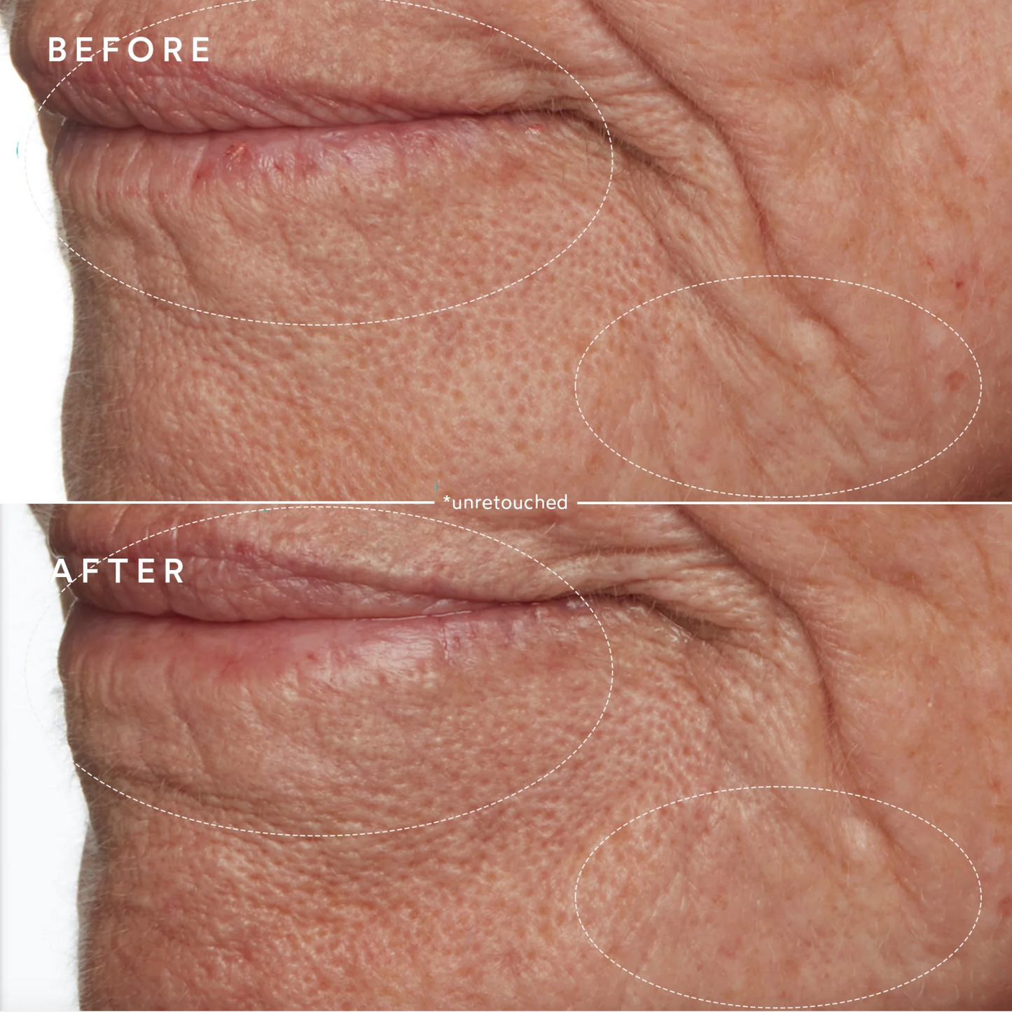 Moisture Lock Overnight Mask