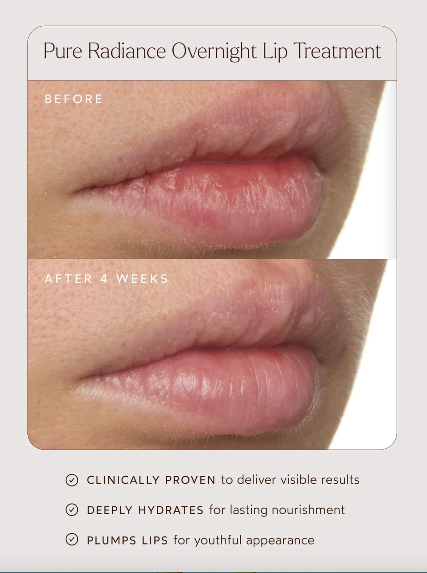 Pure Radiance Overnight Lip Treatment