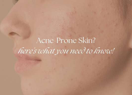 Face Oils for Acne Prone Skin