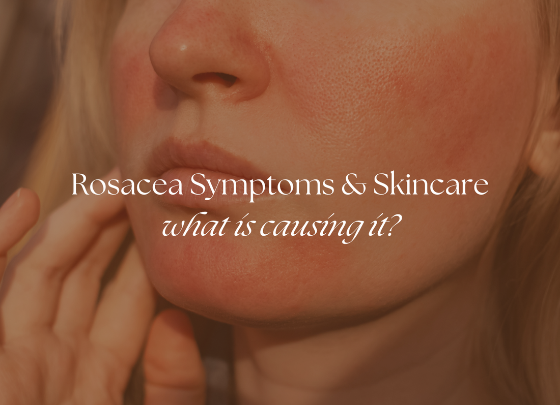 What Is Rosacea?