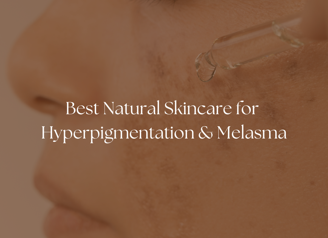 How to Fade Dark Spots Naturally This Summer: Hyperpigmentation & Melasma Awareness Month