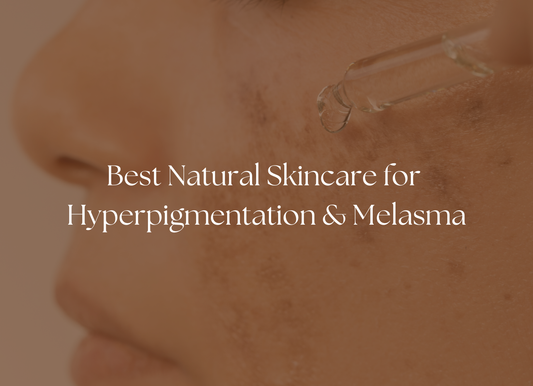 How to Fade Dark Spots Naturally This Summer: Hyperpigmentation & Melasma Awareness Month