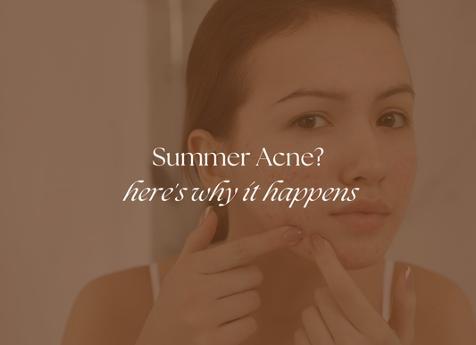 Sweat, Sunscreen & Breakouts: How to Prevent Summer Acne Naturally